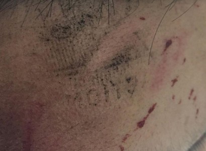 Asian Muslim Man So Violently Assaulted that Perpetrator Left an Imprint on His Head