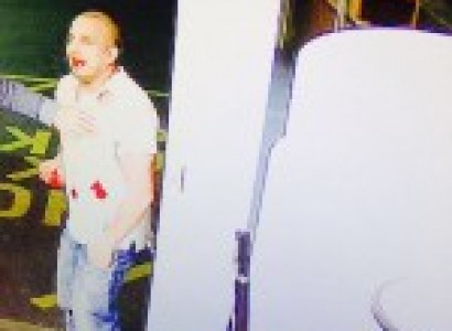 Rotherham – Shocking Pictures Emerge of British Asian Attacked in Racial Incident